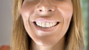 Wellys-x000000ae-GI-021300-Set-de-blanchiment-des-
