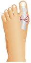 Wellys-GI-017572-Regulateur-d-orteil-de-nuit-Paire